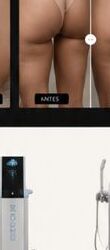EMSCULPT™